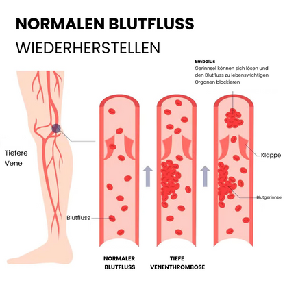 Schulz LLLT nail fungus therapy
