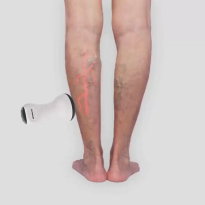 Schulz shock wave therapy device